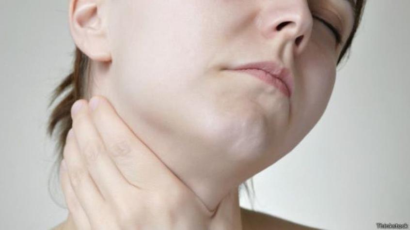 Experta dice que uno de cada cinco chilenos puede padecer algún trastorno a la tiroides