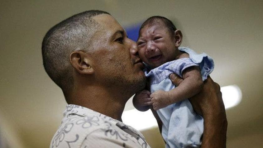 Colombia registra cinco casos de microcefalia por zika