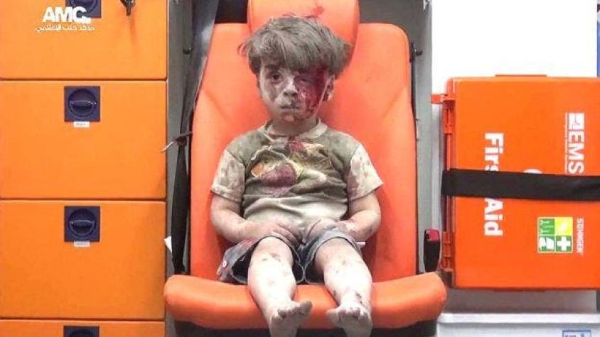 La foto de un niño herido en Alepo que alerta sobre la guerra en Siria