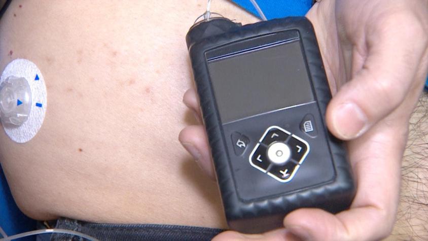 Arturo Vidal pide inclusión de bomba de insulina para niños en Plan Auge