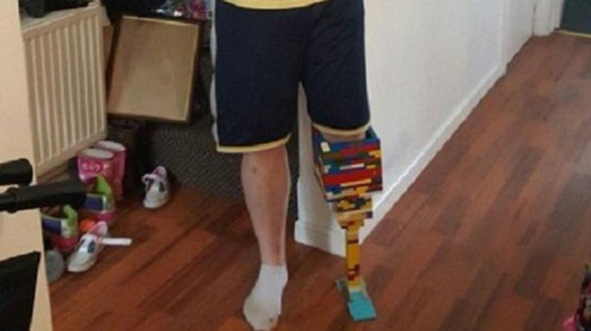 Hombre se construye una pierna de Lego mientras espera una prótesis