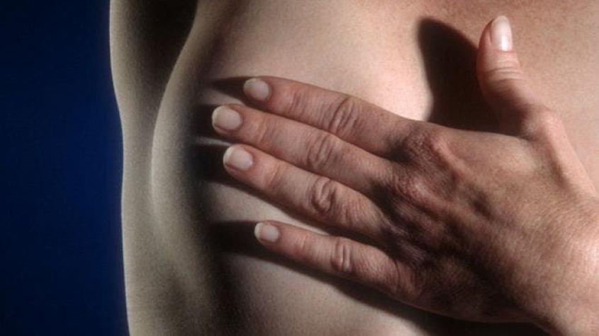 Cuáles son los síntomas menos conocidos del cáncer de mama (más allá de la presencia de un bulto)