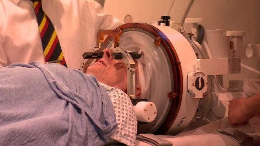 La increíble cirugía cerebral con ondas de sonido que curó a un paciente con temblores