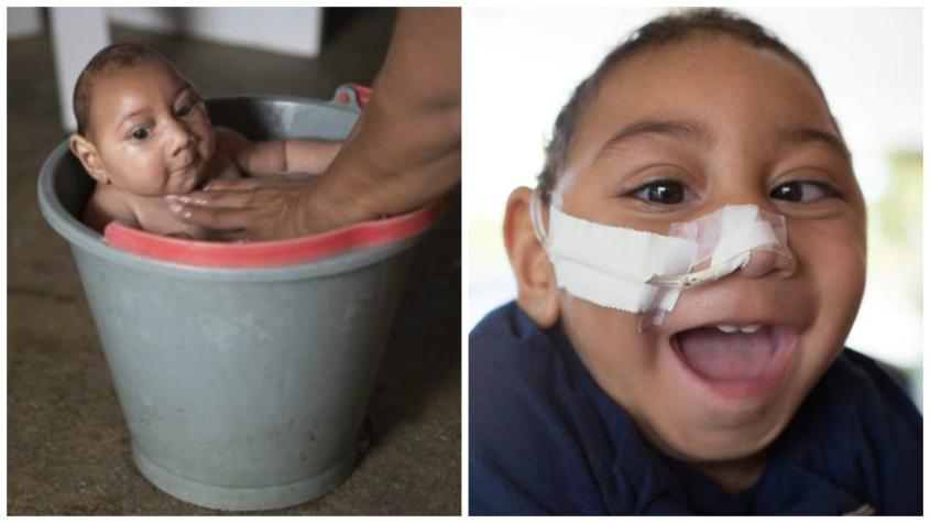 Cómo se encuentra Jose Wesley, el bebé que hace un año fue la cara del Zika