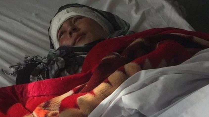 La cruel mutilación que sufrió una mujer afgana a la que su esposo le cortó las dos orejas