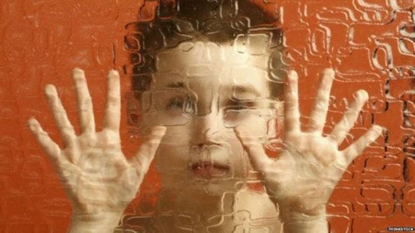 Síndrome de Williams, el trastorno genético raro que hace a los niños demasiado extrovertidos