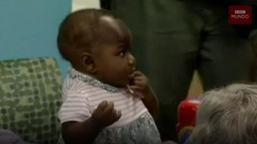 [VIDEO] La bebé a la que extirparon un "gemelo parasitario" que no llegó a desarrollarse