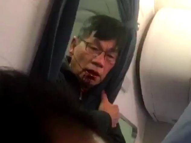 Pasajero sacado a rastras de avión United tiene lesiones y podría demandar