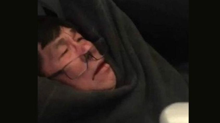 El hombre expulsado de un avión de United Airlines demanda a la aerolínea