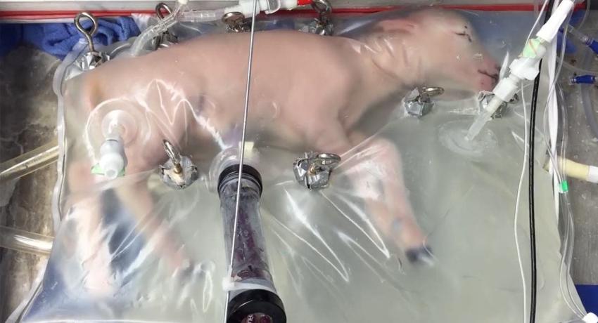 Científicos desarrollan una bolsa plástica que recrea un útero para bebés prematuros