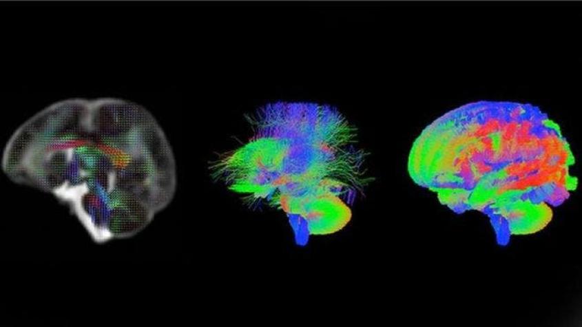 Registran por primera vez cómo se forman trillones de conexiones en el cerebro de los bebés