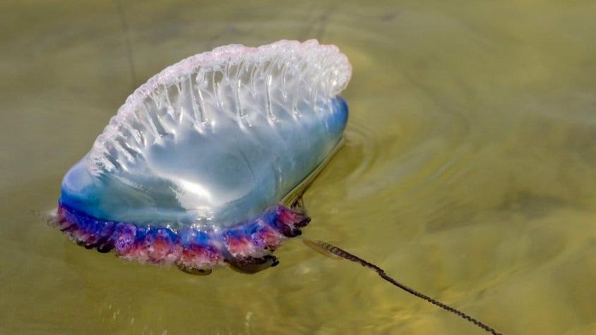 El mejor tratamiento para la picaduras de medusa (y la respuesta no es la orina)