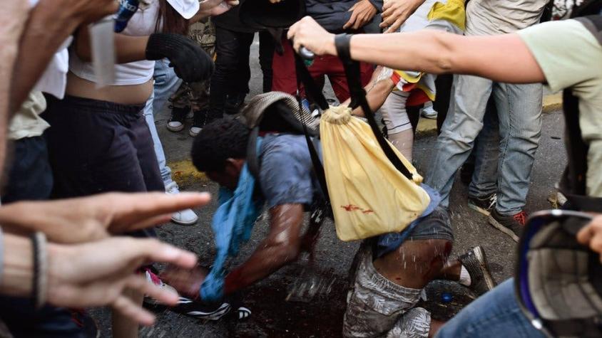 Lo que se sabe del joven al que prendieron fuego durante una protesta en Venezuela