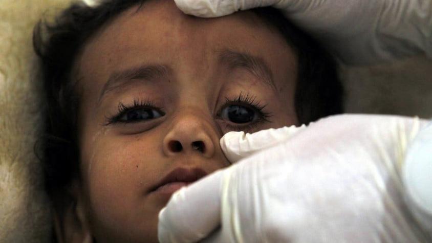 Asi se vive el horror de la crisis del cólera sin precedentes de Yemen