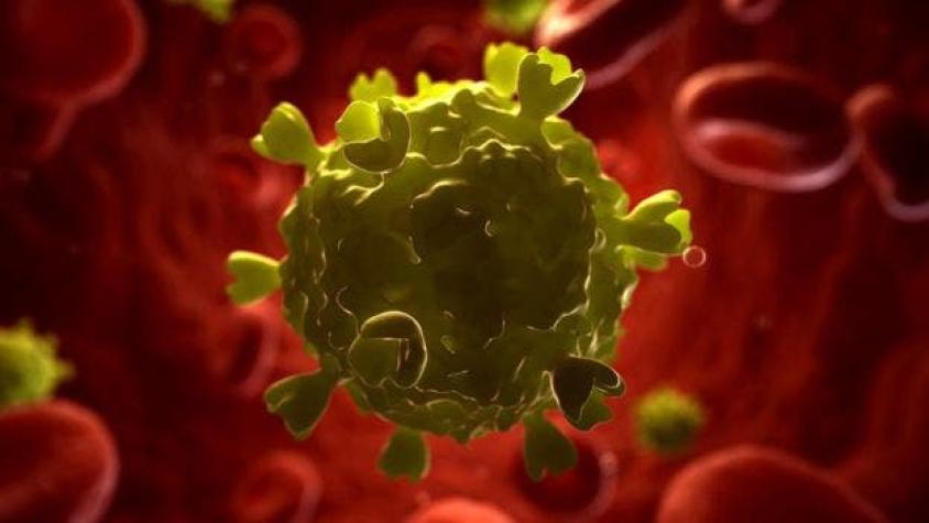 Minsal planifica nuevo test para diagnóstico rápido de VIH