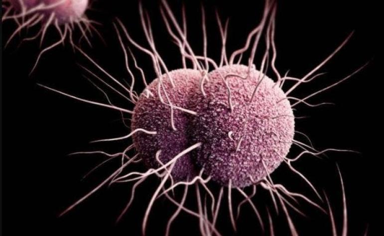 La Gonorrea: La enfermedad de transmisión sexual que se vuelve cada vez más difícil de tratar