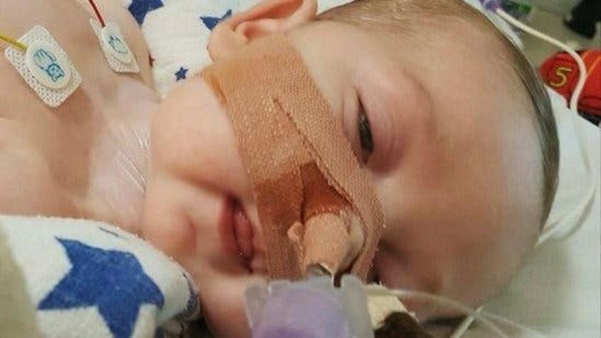 ¿Cuál es la terapia experimental que un hospital de Nueva York ofreció al bebé Charlie Gard?