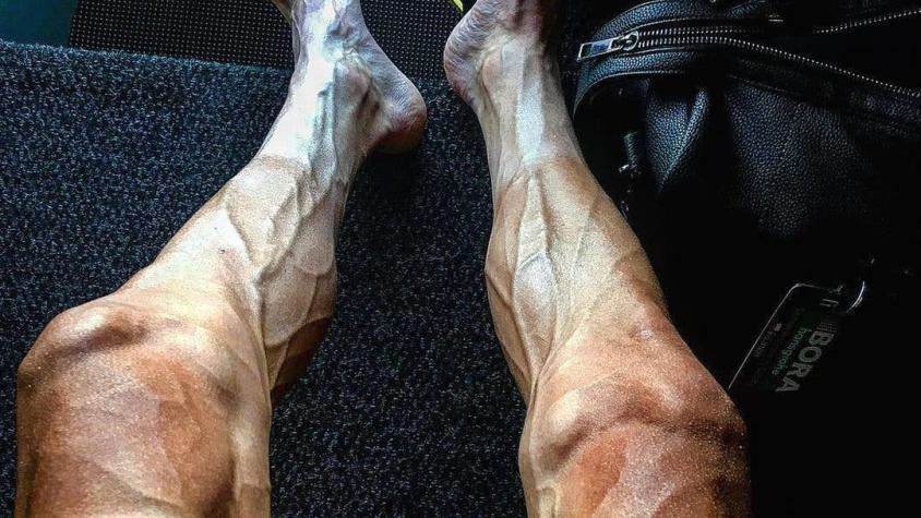 La impresionante foto de la transformación de las piernas de un ciclista durante el Tour de Francia