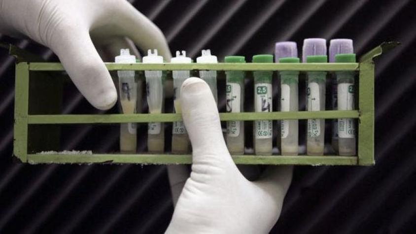 Ministerio de Salud analiza viabilidad de vender test rápidos de VIH
