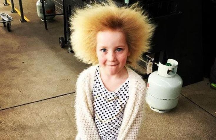 Esta niña sufre el "Síndrome del cabello impeinable"