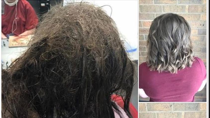 Las peluqueras que rehusaron afeitarle la cabeza a una adolescente que sufría de depresión