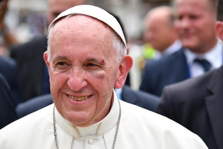 Papa Francisco se hiere el rostro al golpearse contra el papamóvil en Colombia