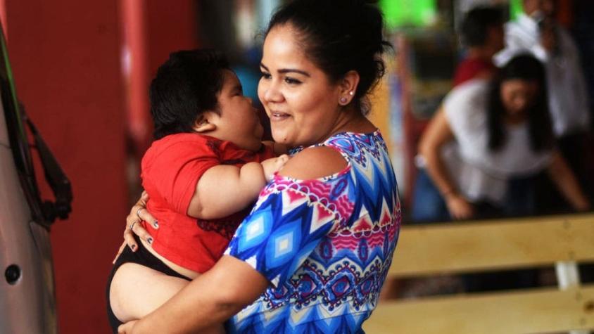 Cómo se explica la obesidad del bebé mexicano que a los 11 meses pesa 28 kilos