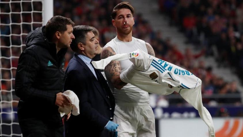 Real Madrid confirma fractura de nariz de Ramos: “Volvería a sangrar una y mil veces más”