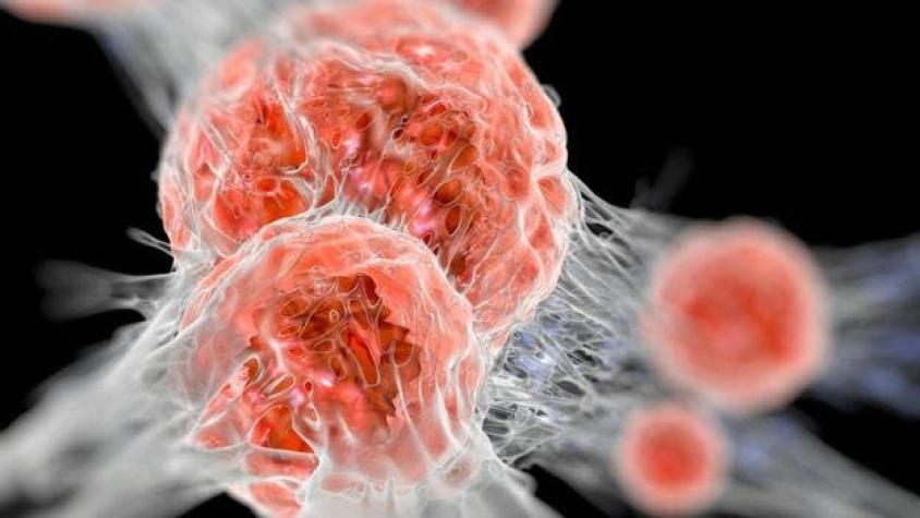 Por qué hay mujeres que evitan hacerse una crucial prueba para detectar cáncer