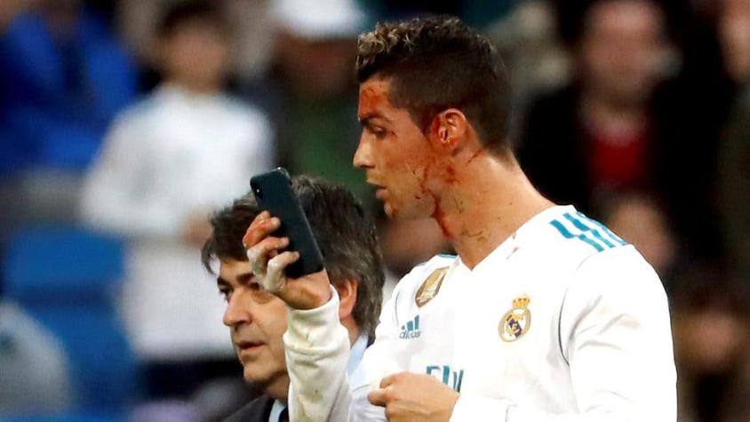 La llamativa reacción de Cristiano Ronaldo tras recibir un golpe en la cara