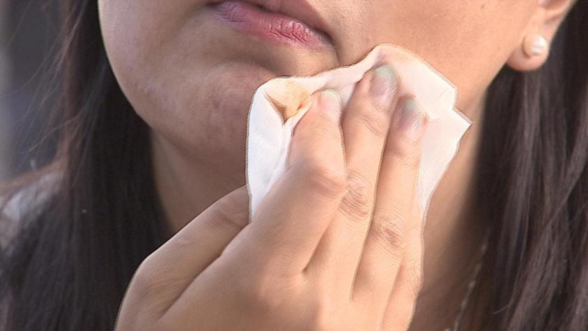 [VIDEO] ISP alerta por compuestos dañinos en cremas para la piel