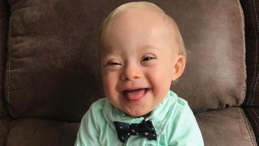 Lucas, el bebé con síndrome de Down que será el rostro de la marca de comida para niños Gerber