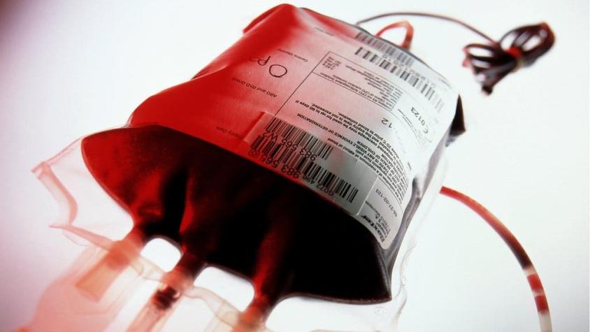 Las polémicas transfusiones de sangre joven solo para millonarios en California