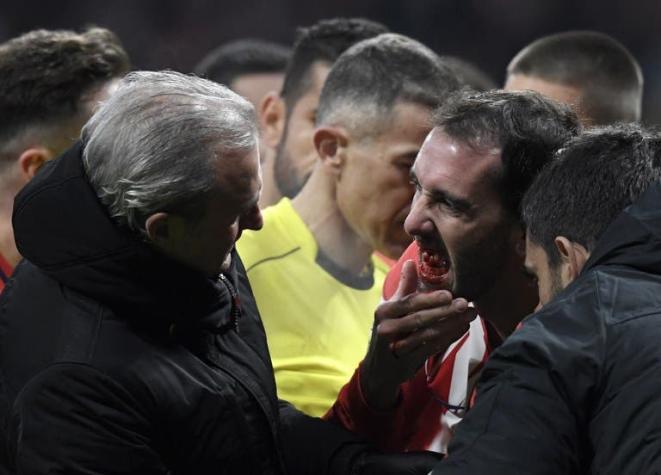 Diego Godín vuelve a jugar tras perder tres dientes en un partido