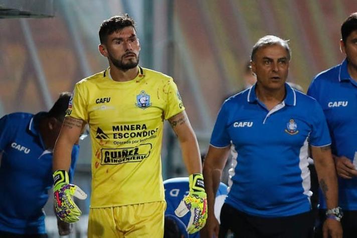 Paulo Garcés permanecerá en reposo por siete días tras sufrir una fractura nasal