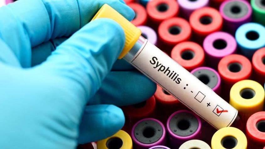 "Pensé que era una enfermedad de la Edad Media": cómo la sífilis está aumentando en el mundo