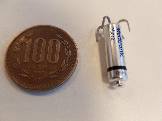 [VIDEO] Es del porte de una moneda: realizan implante de marcapasos más pequeño del mundo en Chile