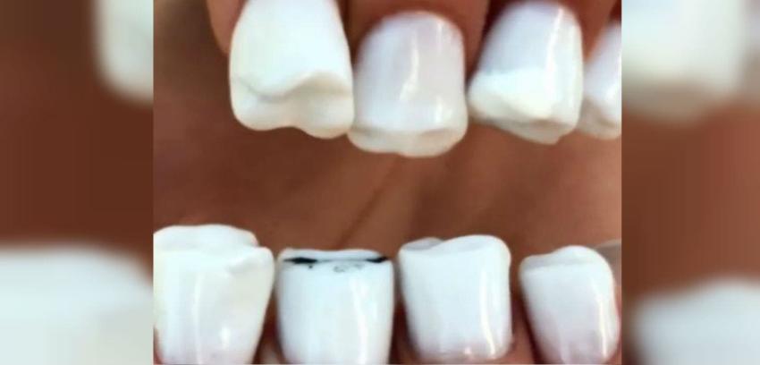[VIDEO] Las "uñas dientes" existen (y son asquerosas)