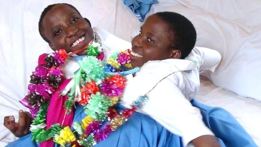 Las mellizas siamesas de Tanzania cuya muerte a los 21 años conmovió al país