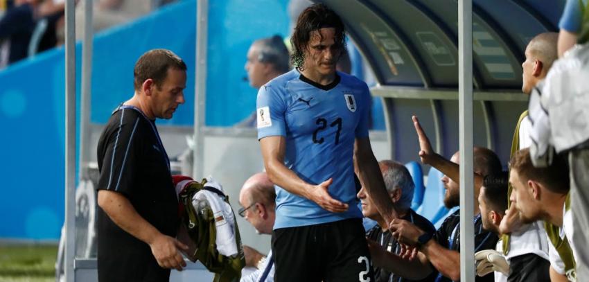 En Uruguay dan por hecho que Edinson Cavani no será titular ante Francia en Rusia 2018