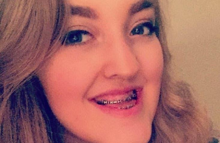 [FOTOS] La increíble transformación de mujer que sufrió "bullying" por el tamaño de su mandíbula