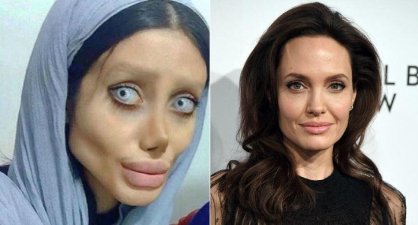 [FOTOS] La joven iraní que se obsesionó con ser igual a Angelina Jolie
