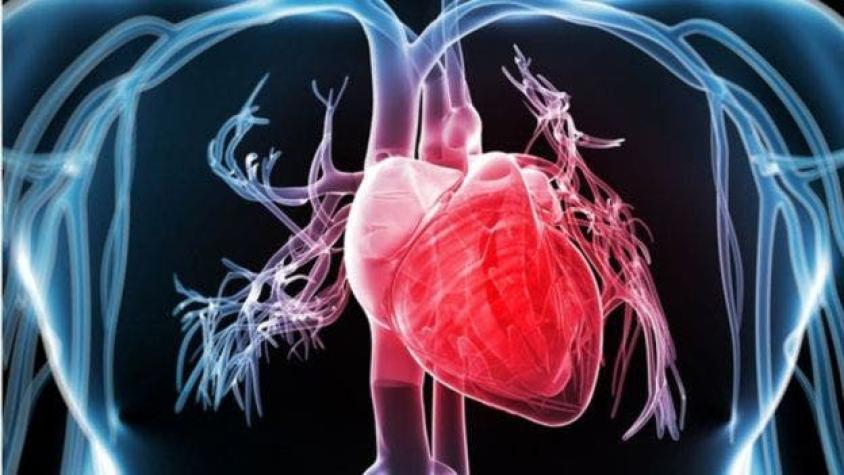 Mes del corazón: ¿Cómo prevenir un infarto?