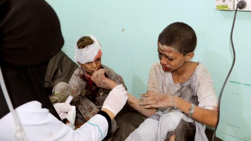 Al menos 29 niños que viajaban en un autobús escolar mueren en Yemen tras un ataque aéreo