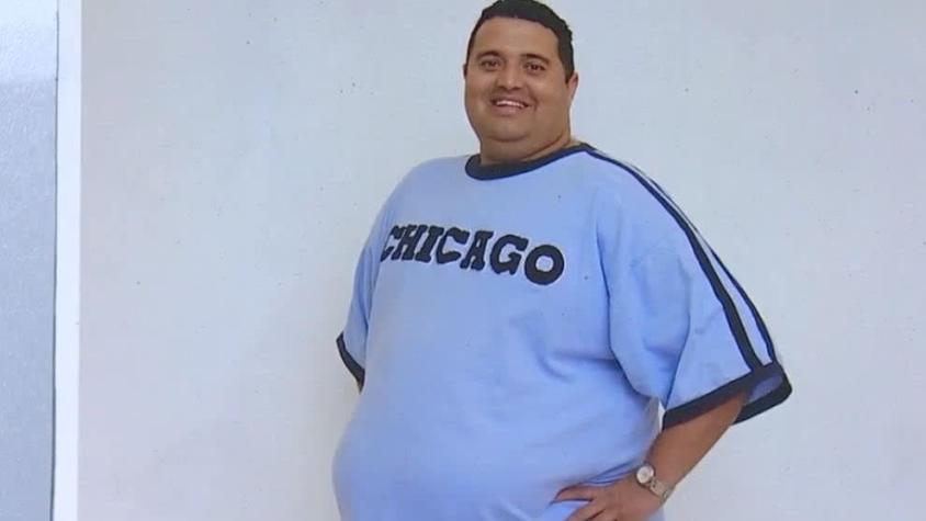 [FOTOS] El colombiano que bajó 137 kilos luego de fracasar con distintos tipos de dieta