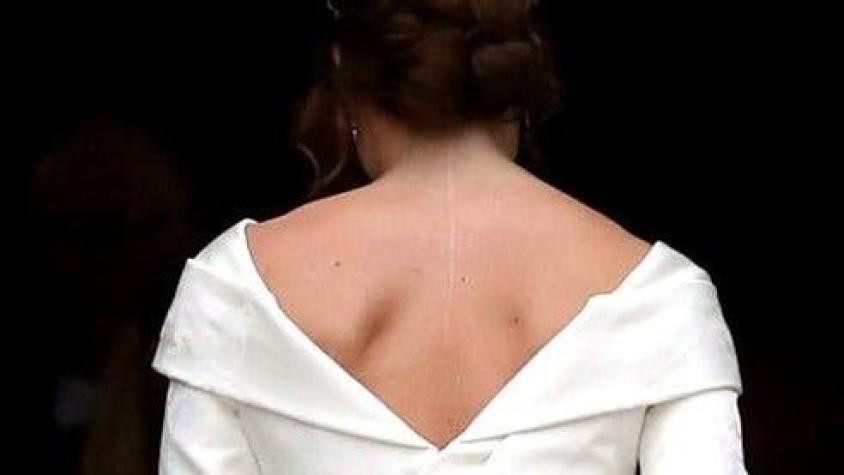 Boda de la Princesa Eugenia de York: "Quería que mi vestido de novia mostrara mi cicatriz"