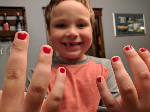 La notable defensa de un padre luego que su hijo sufriera "bullying" por pintarse las uñas