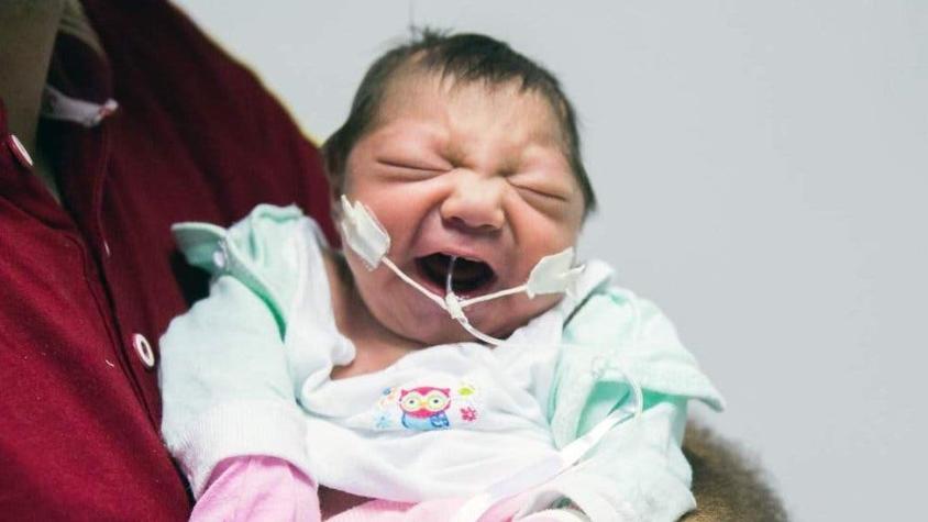 Virus del Zika en Brasil: el relato de las madres de los bebés que nacieron con microcefalia