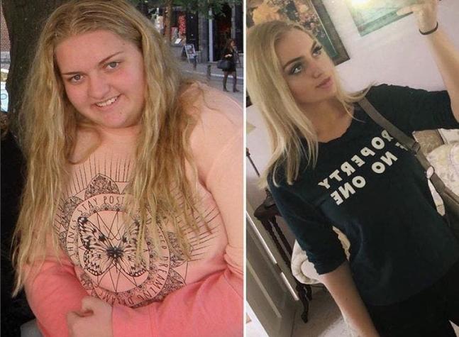 [FOTOS] El increíble "antes y después" de joven que bajó 63 kilos tras sufrir bullying en el colegio