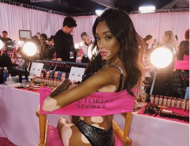 Winnie Harlow, mujer con vitiligo en desfile Victoria's Secret